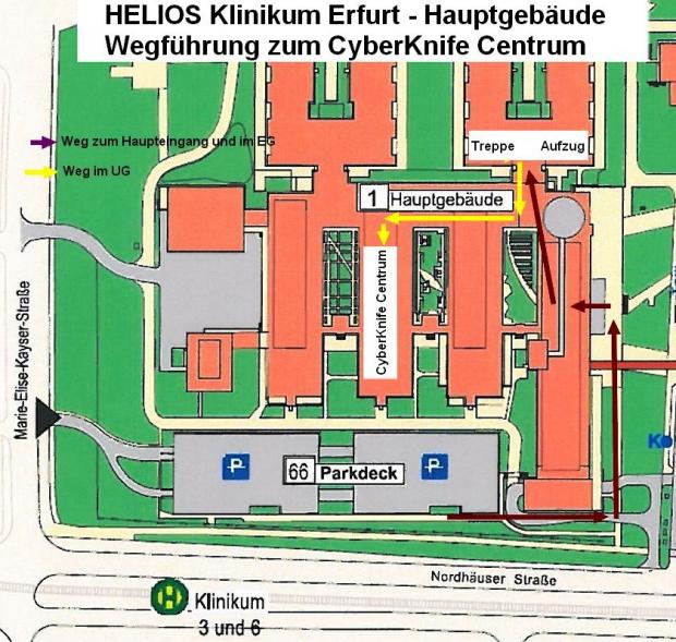 wegefuehrung_cyberknife_0.jpg